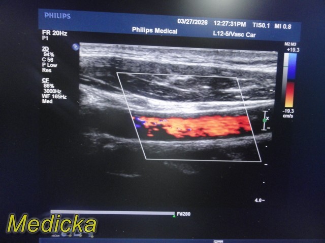Philips L12-5 Linear Array Ultrasound Transducer (P/N 453561497452) ~ 39218