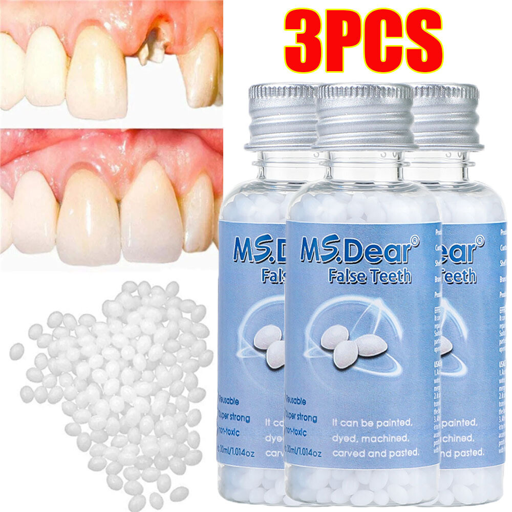 3X Tooth Repair Kit - Temporary Teeth Replacement Kit for Missing & Broken Teeth