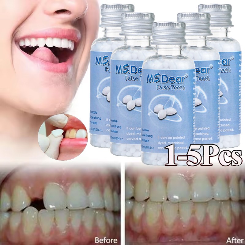 Resin False Teeth Solid Glue Temporary Tooth Gap Filler Tooth Repair Moldable US