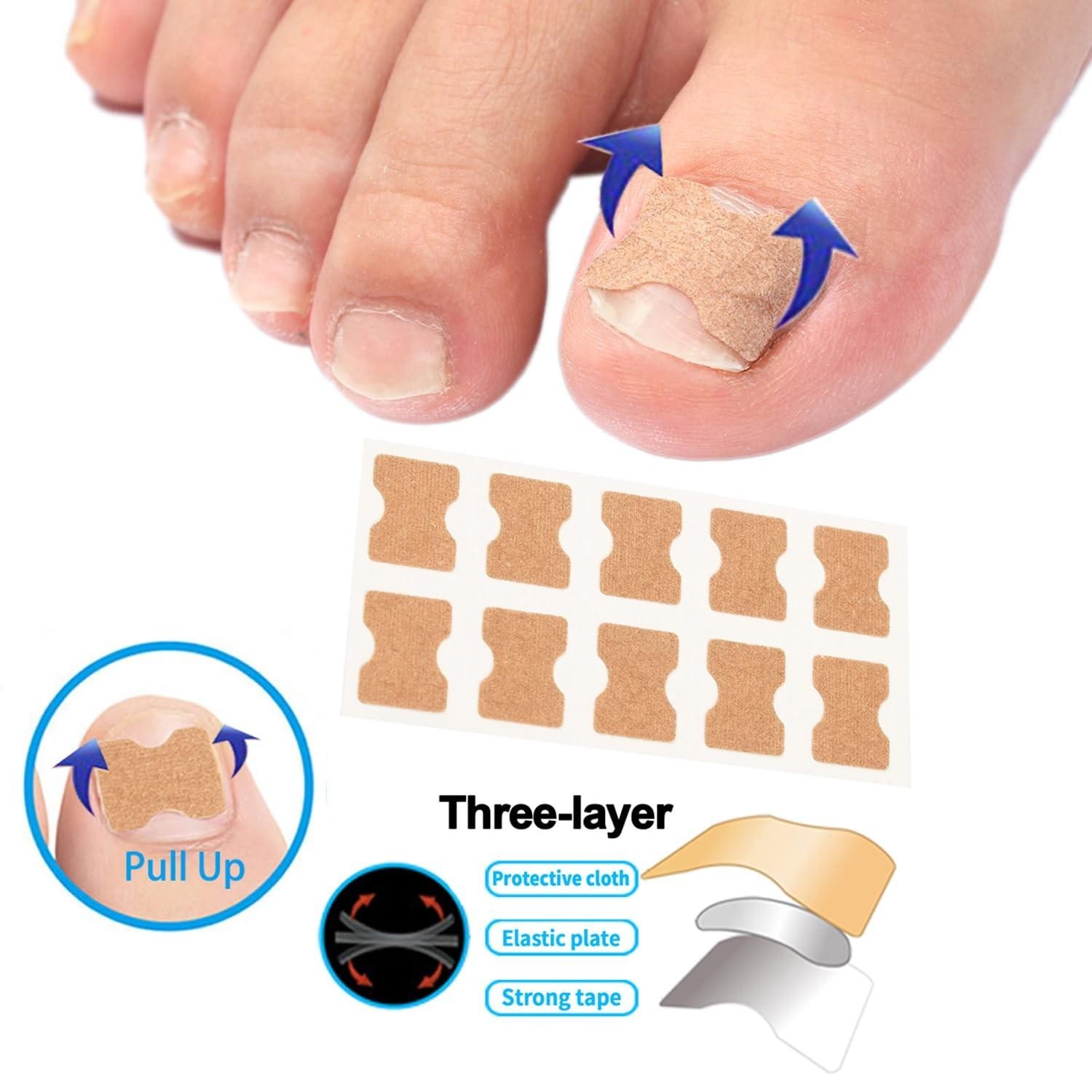 Ingrown Toenail Corrector Set with Correction Strips,professional Ingrown Toe...
