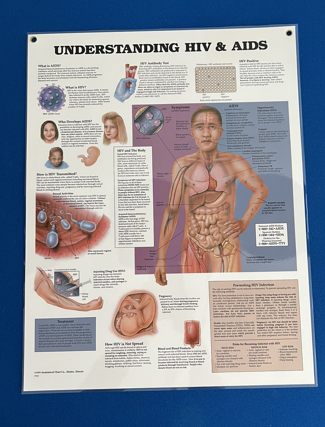 Vintage 1993 Anatomical Chart CO. “Understanding HIV & AIDS” 26x20 Very Rare