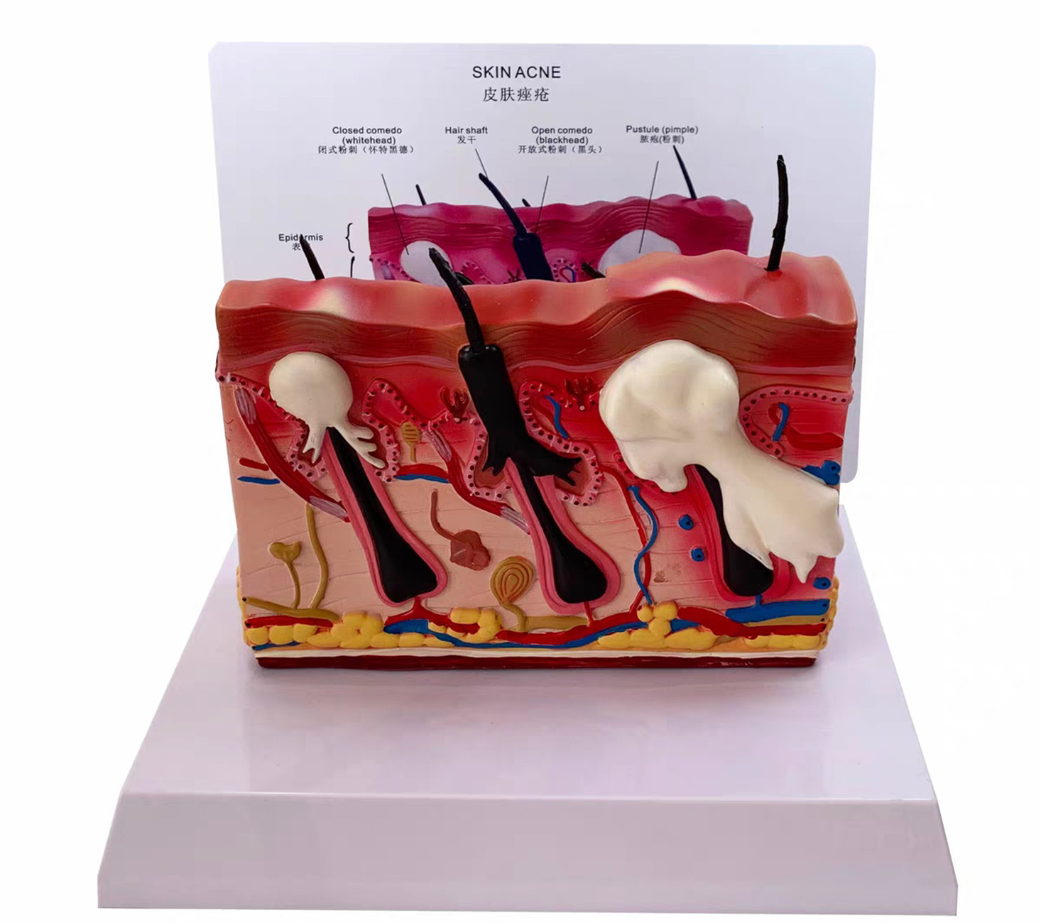 Human Skin acne epidermis hair follicle dermis Model anatomy teaching medical