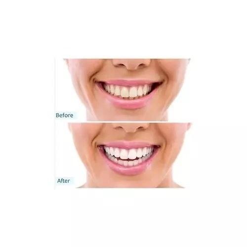 Pack Of 6 Pepsodent Complete Care Toothpaste Original 5.5 Oz Each Fast Shipping