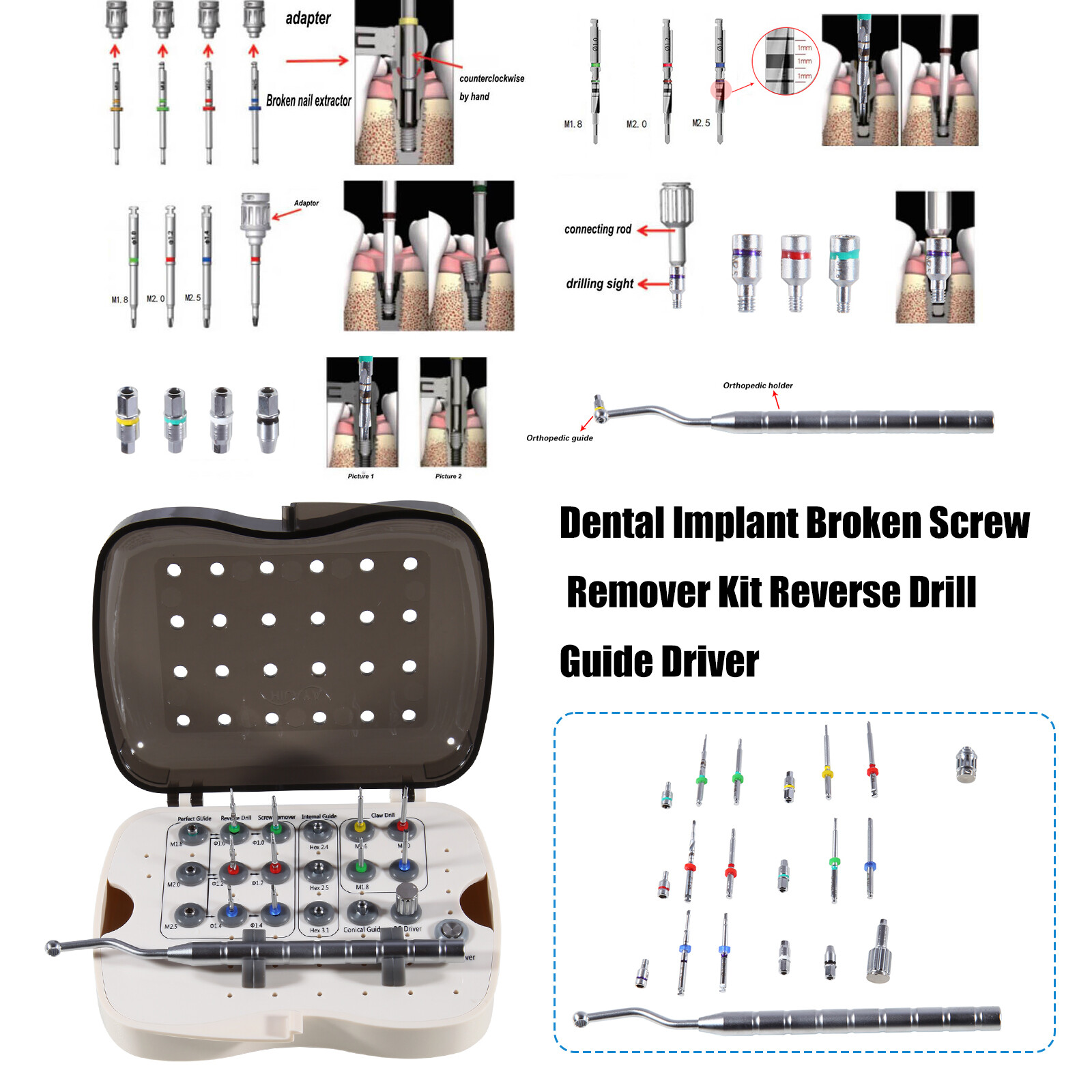 Dental Implant Broken Screw Remover Kit Reverse Drill Guide Driver Neobiotech SR