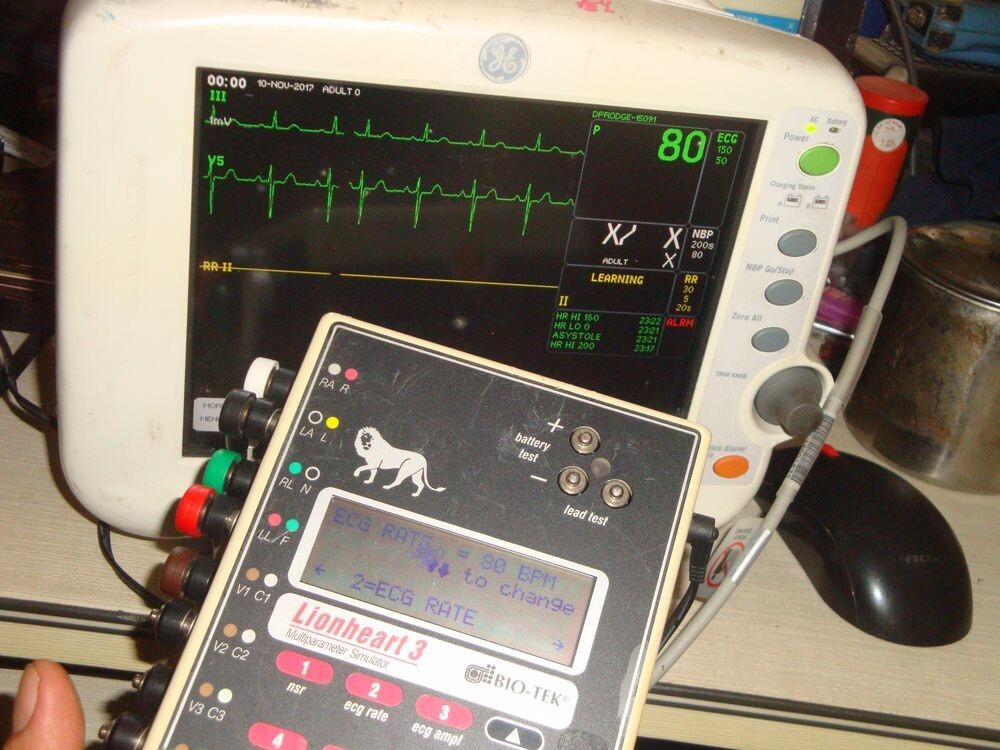 LCD Display Aging Fluke Bio-Tek Lionheart 3 Multiparameter Patient Simulator