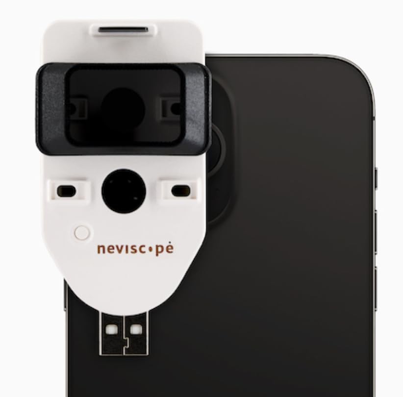 Neviscope Black Phone Dermatoscope Microscope with Polarized Lens/LED Light, ...
