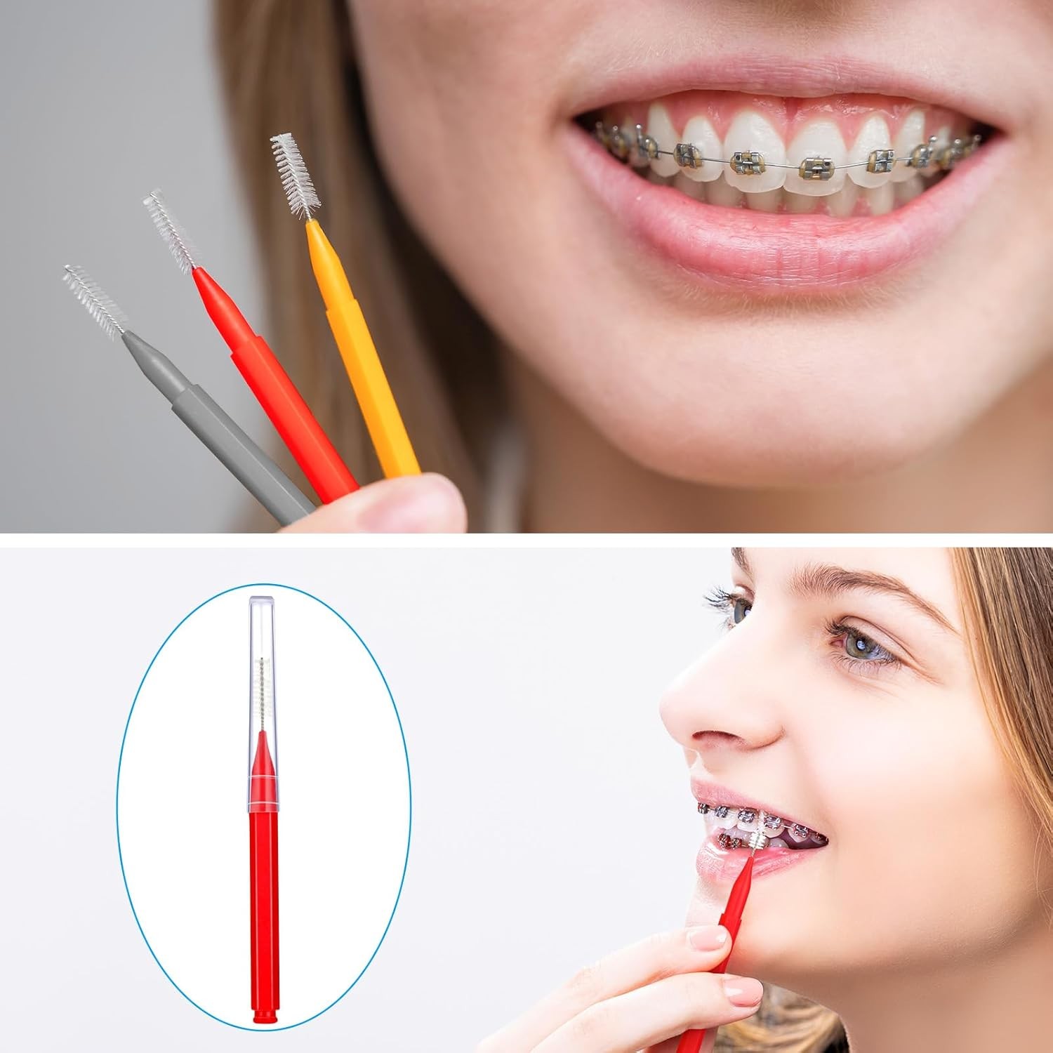 Patelai 100 Pieces Braces Brush for 1 Count (Pack of 100), Classic Colors