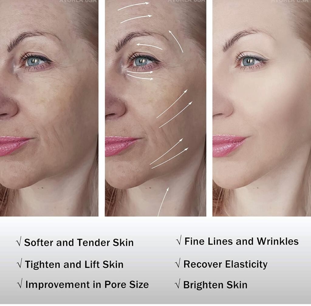 SPITHA R F - Wrinkle Removal Anti Aging Body and Face Beauty Machine