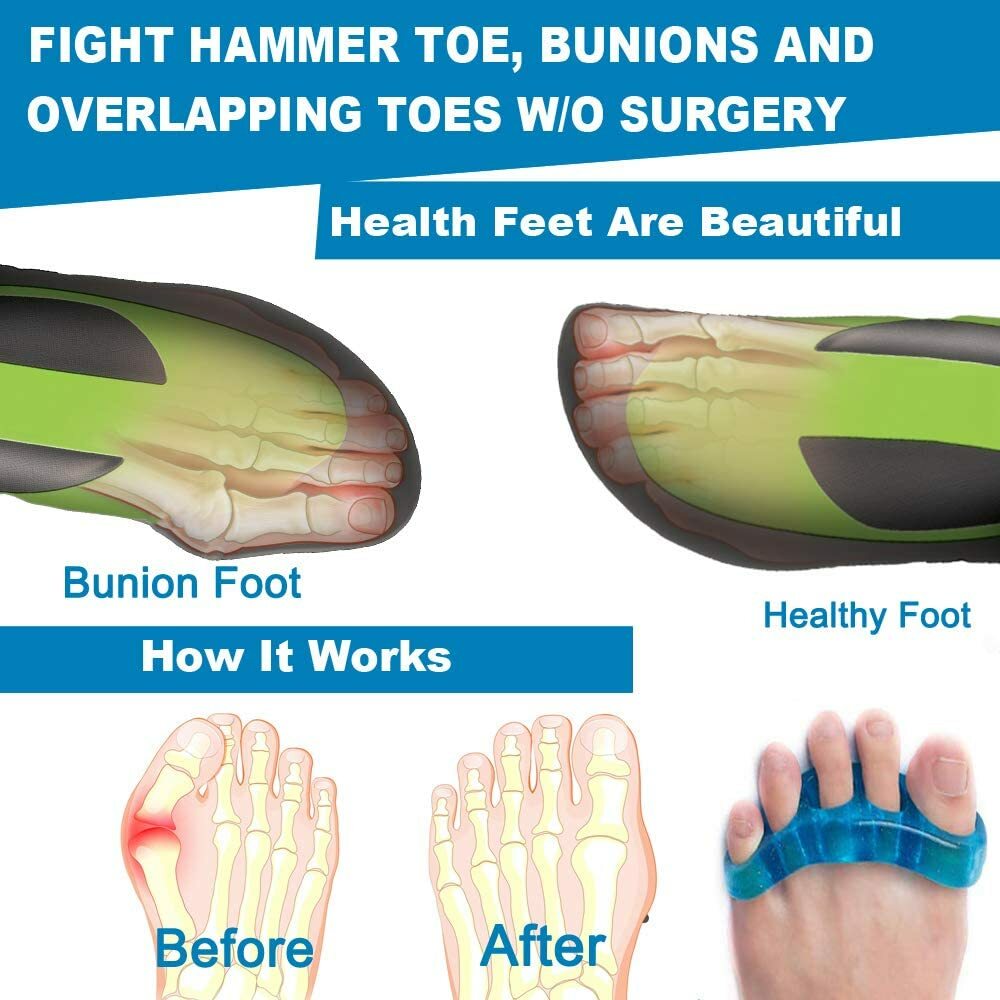 Premium Gel Toe Separators-Spacers & Straighteners-Bunion Correctors-5 Pc Set