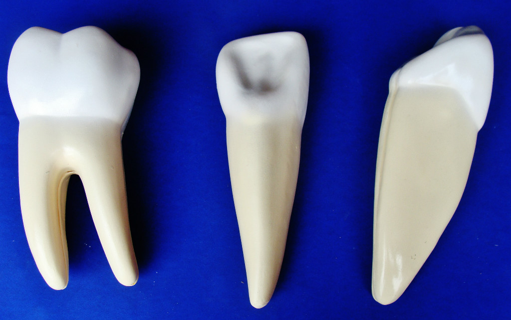Model Anatomy Professional Medical Human Teeth Expansion Large IT-043 ARTMED