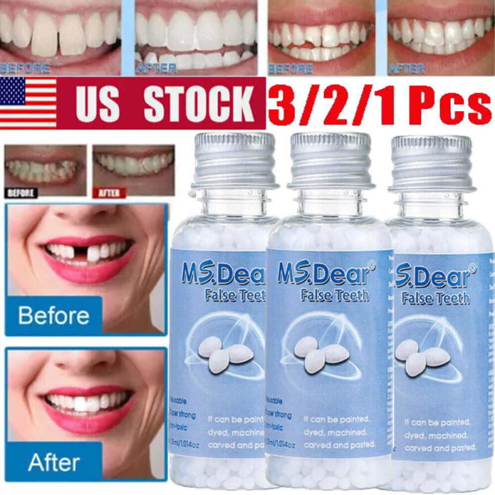 3/1x Tooth Repair Granules Temporary Reusable Moldable False Teeth Fitting Beads