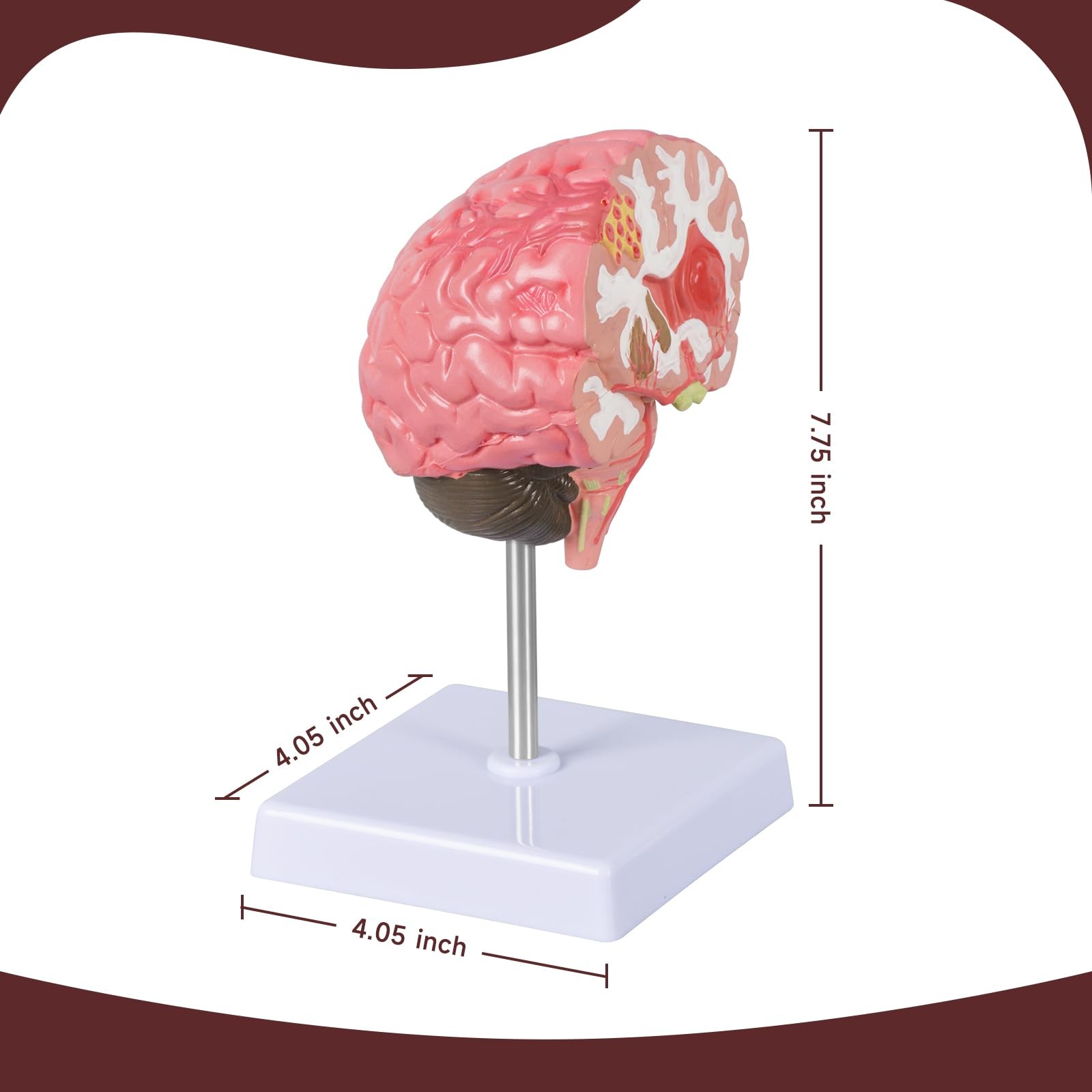 Brain Stroke Anatomy Model, Life-Size Human Brain Structure Anatomical Model,...