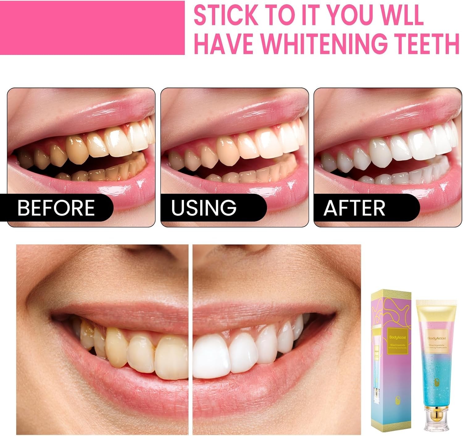 BodyAccel Niacinamide Whitening Toothpaste 3.5 oz Sealed