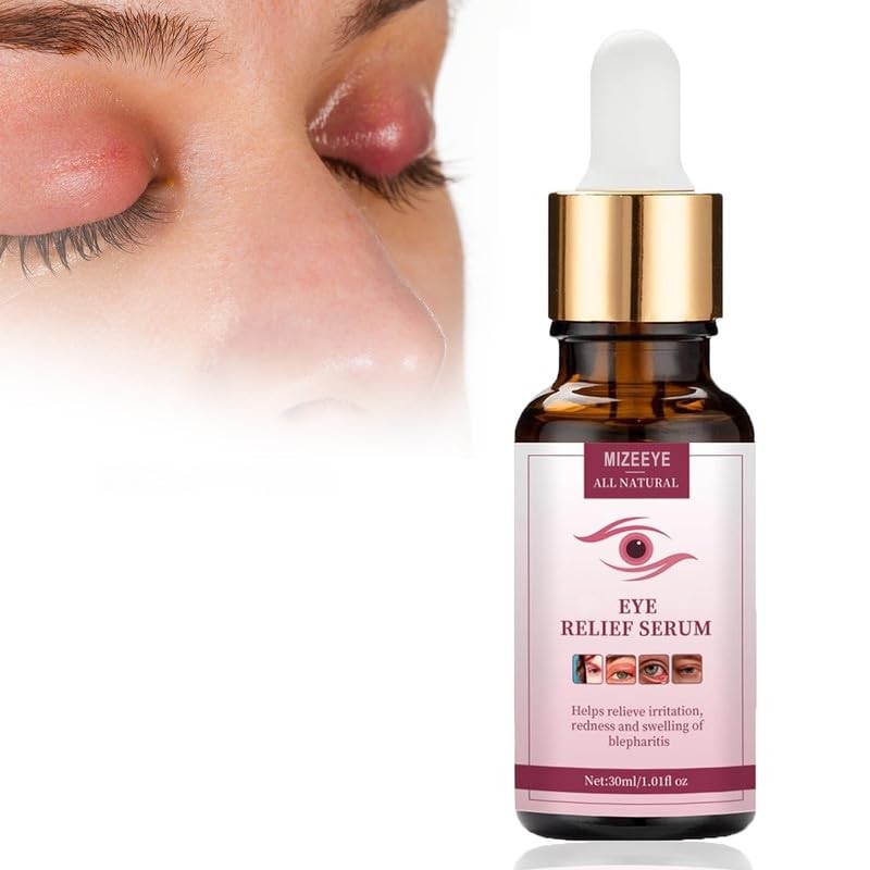Effective Chalazion Eye Treatment Serum for Blepharitis, 30ml Hydration