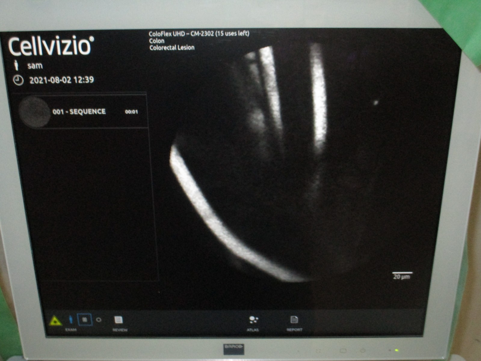 Cellvizio ColoFlex UHD Miniprobe tested