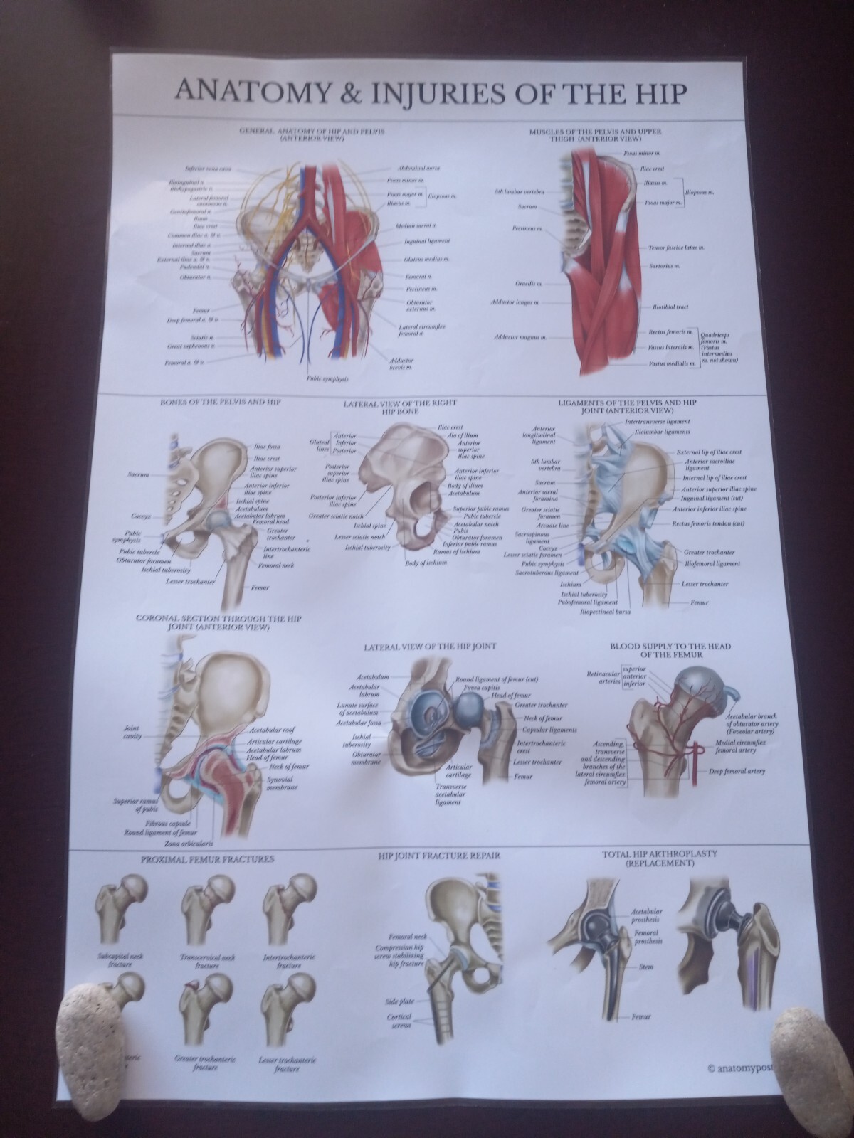 Laminated Anatomy and Injuries of The Hip Poster Hip Joint Anatomical Chart