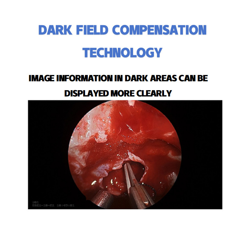 4k Endoscopy Laparoscopic Camera System Ultra HD Endoscope Camera Multiple surg