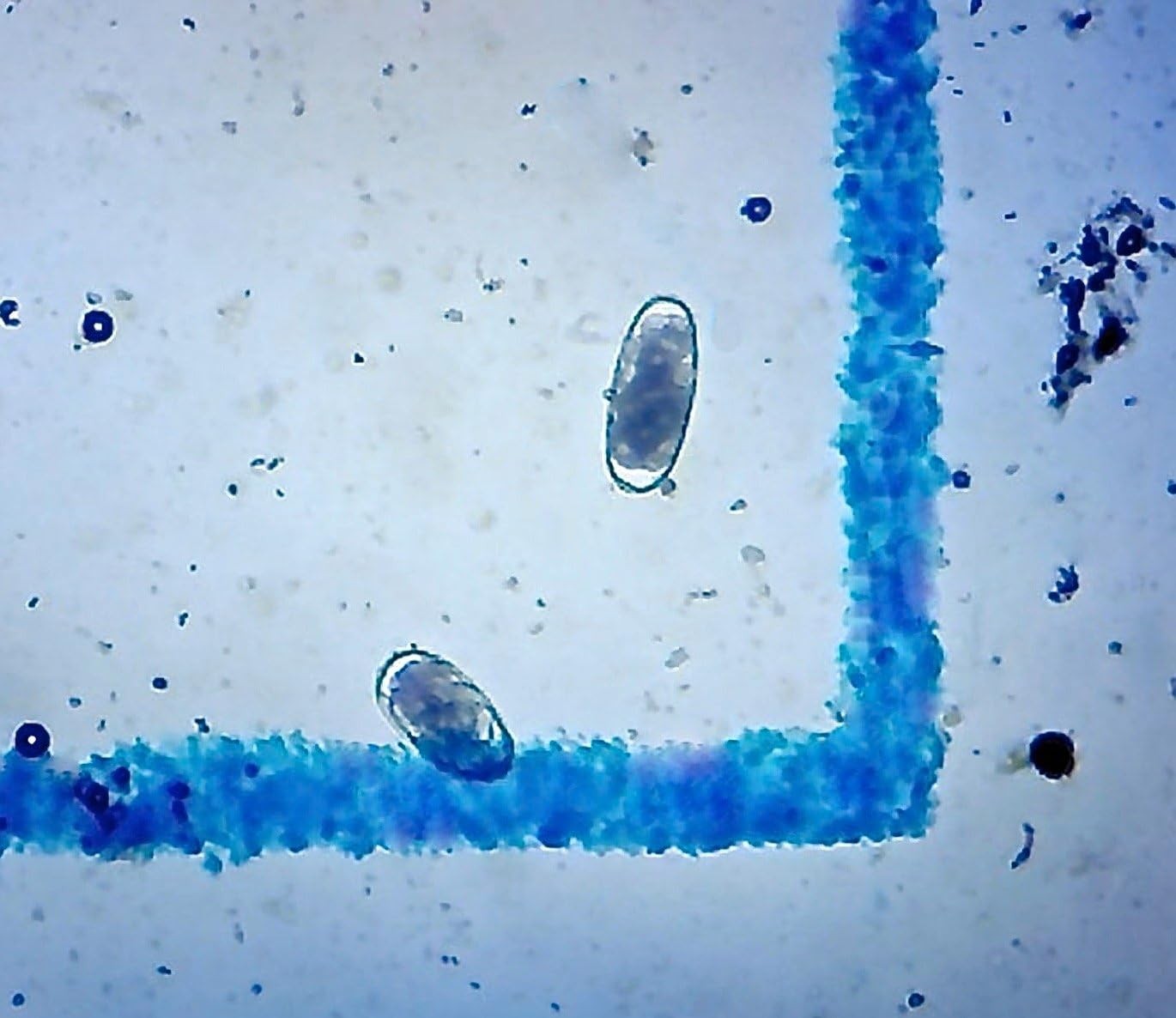 McMaster Method Microscope Slide - FEC (Fecal Egg Count) or Worm Count, Double C