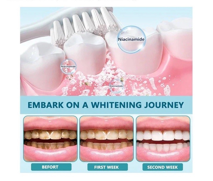 Niacinamide Whitening Toothpaste exp 5/20/2028