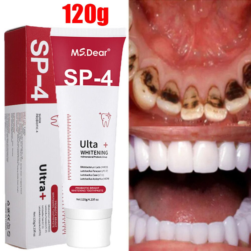 Sip-4 Toothpaste, Whitening Sp-4 Toothpaste, Sp-4 Probiotic Whitening Toothpaste