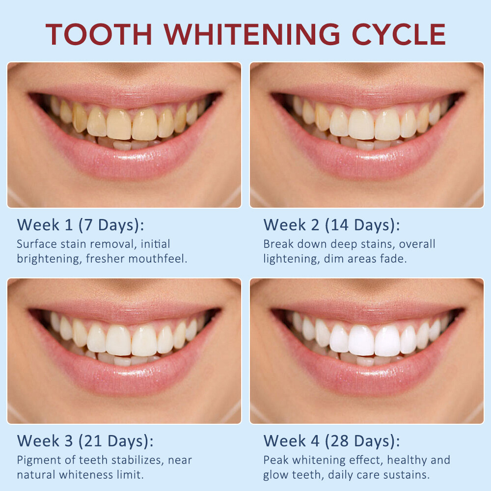 2Pack SP-6 Probiotic Toothpaste,Sp-6 Toothpaste Whitening Quick White Toothpaste
