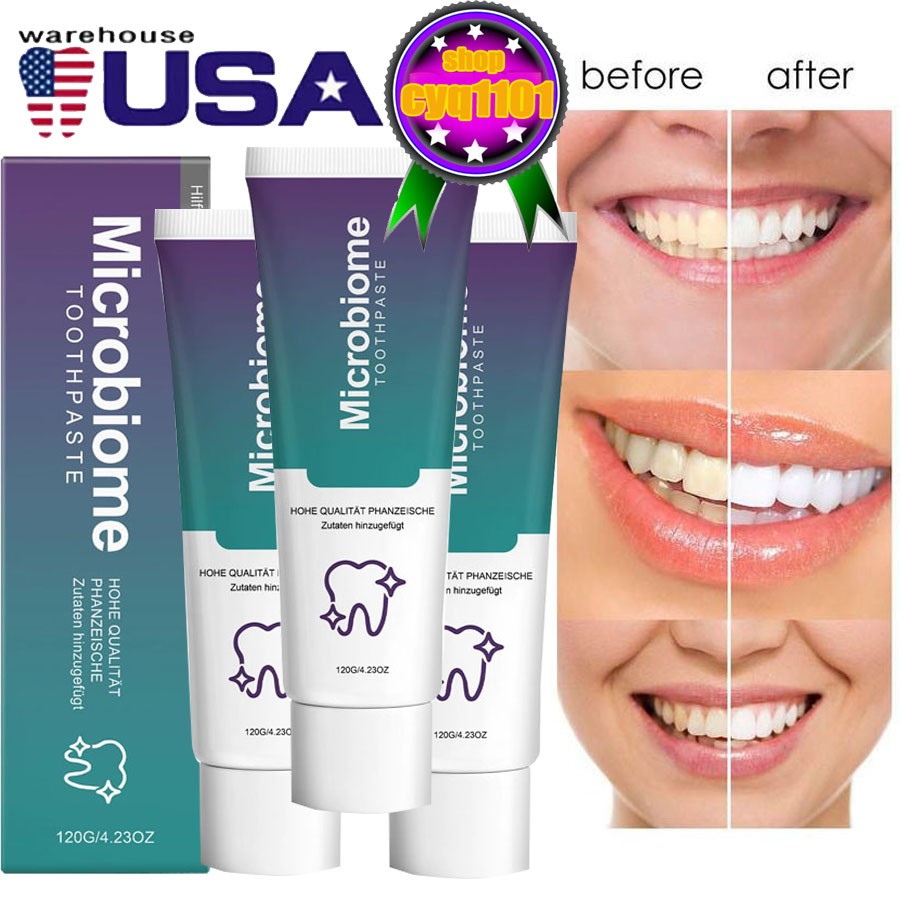 5PCS Microbiome Mint Flavor Gum Toothpaste Cleaning Toothpaste Sensitive Teeth