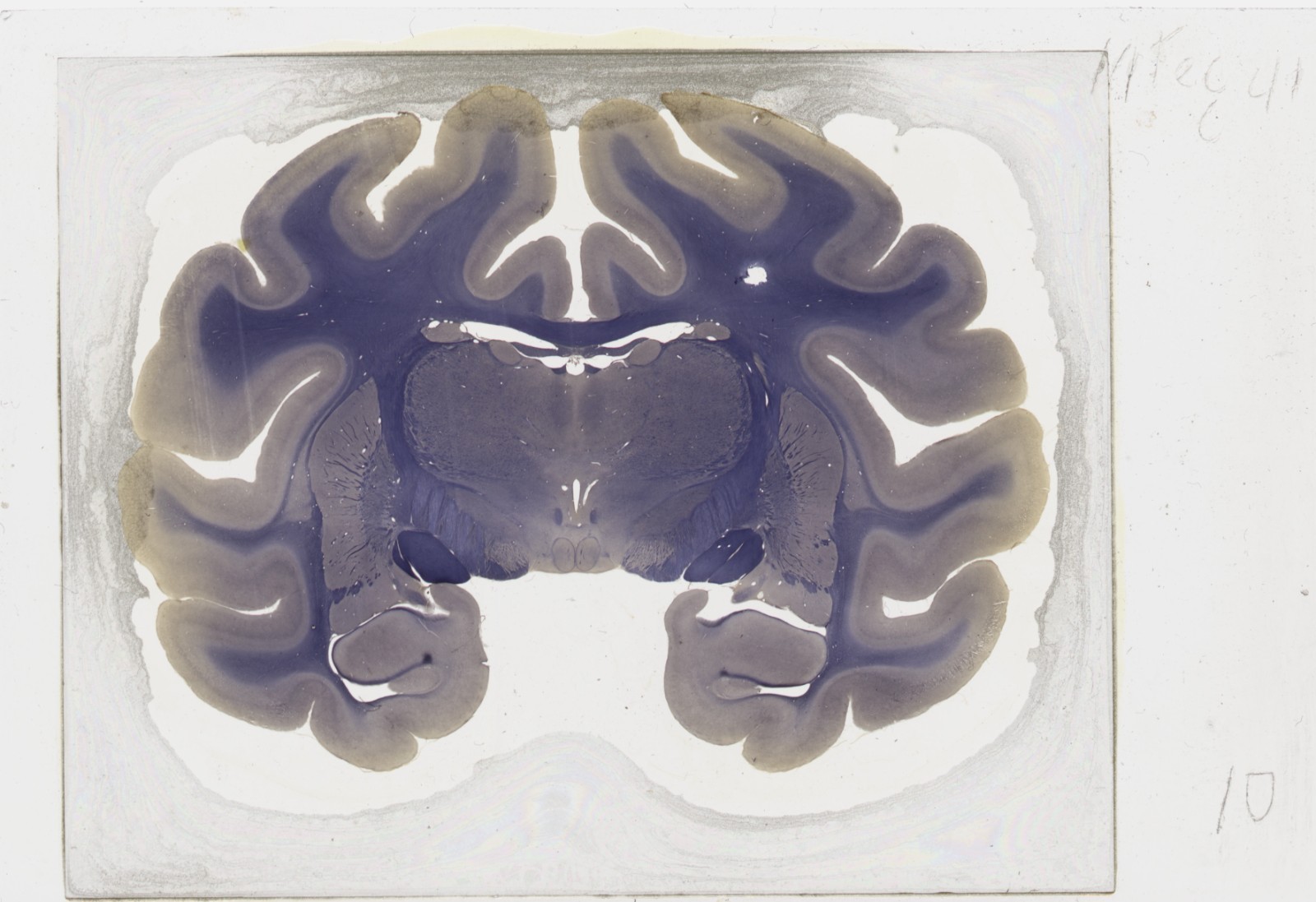 Rhesus Monkey Brain Oversized Microscope Slide - Free worldwide shipping!