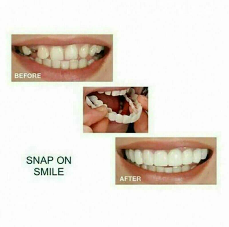 Upper Lower Teeth Silicone Veneers Dentures Snap-on Teeth Kit False Teeth