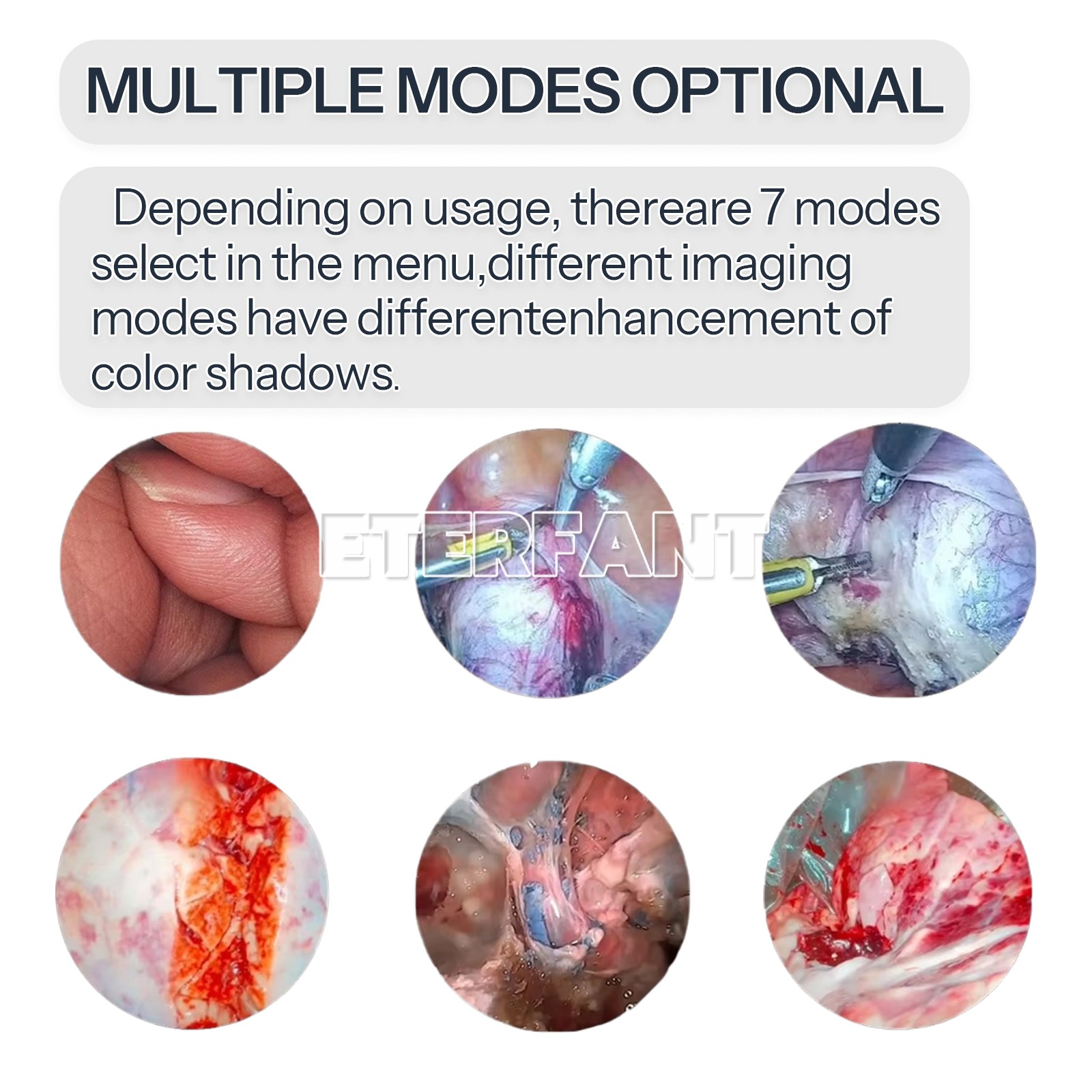 Medical ENT Endoscope Laparoscopic Camera/USB Type Handle/Cold Light Source US