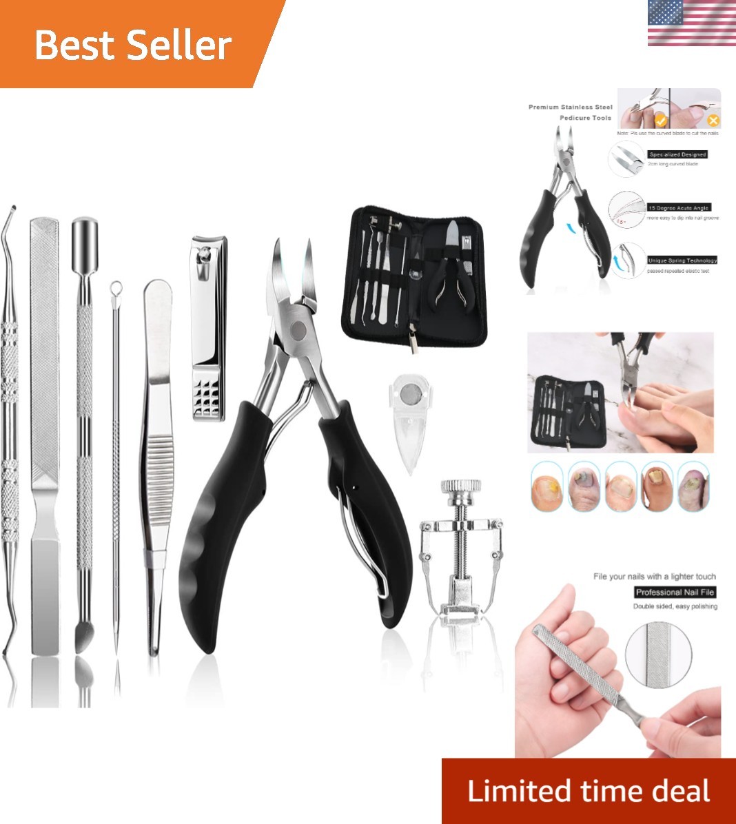 Ingrown Toenail Removal & Correction Tools - 10-Piece Professional Kit