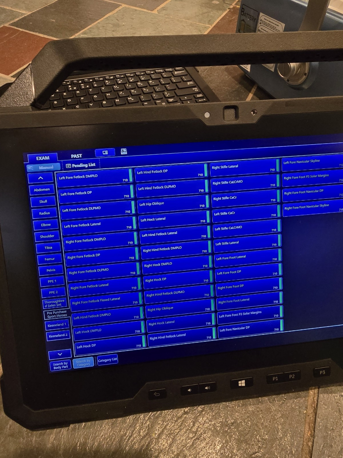 wireless DR panel digital ray