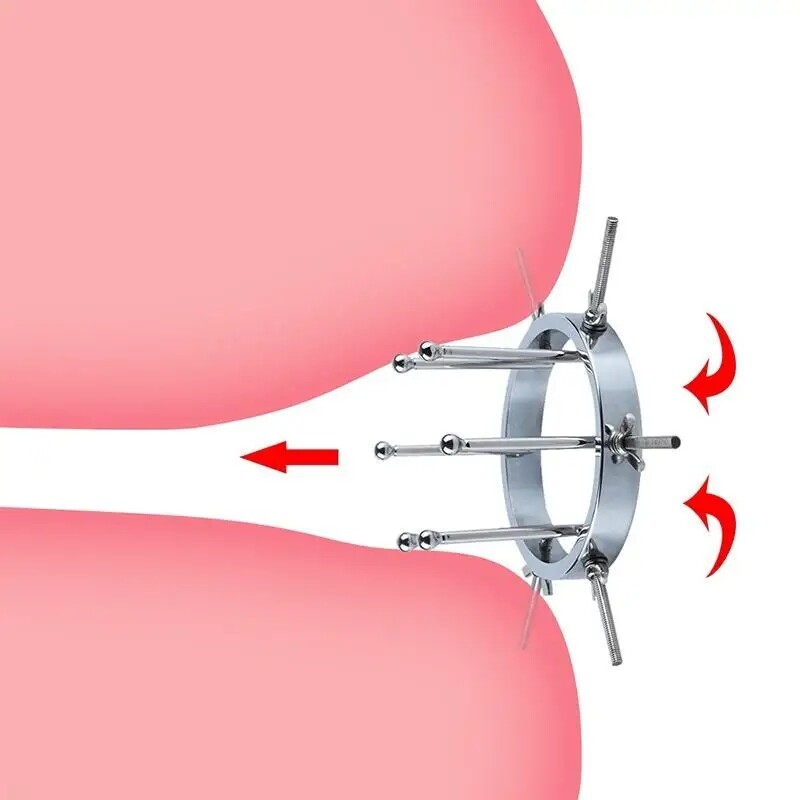 Adjustable Huge Plug Extreme Spreader stretcher Vaginal Speculum Chastity Device