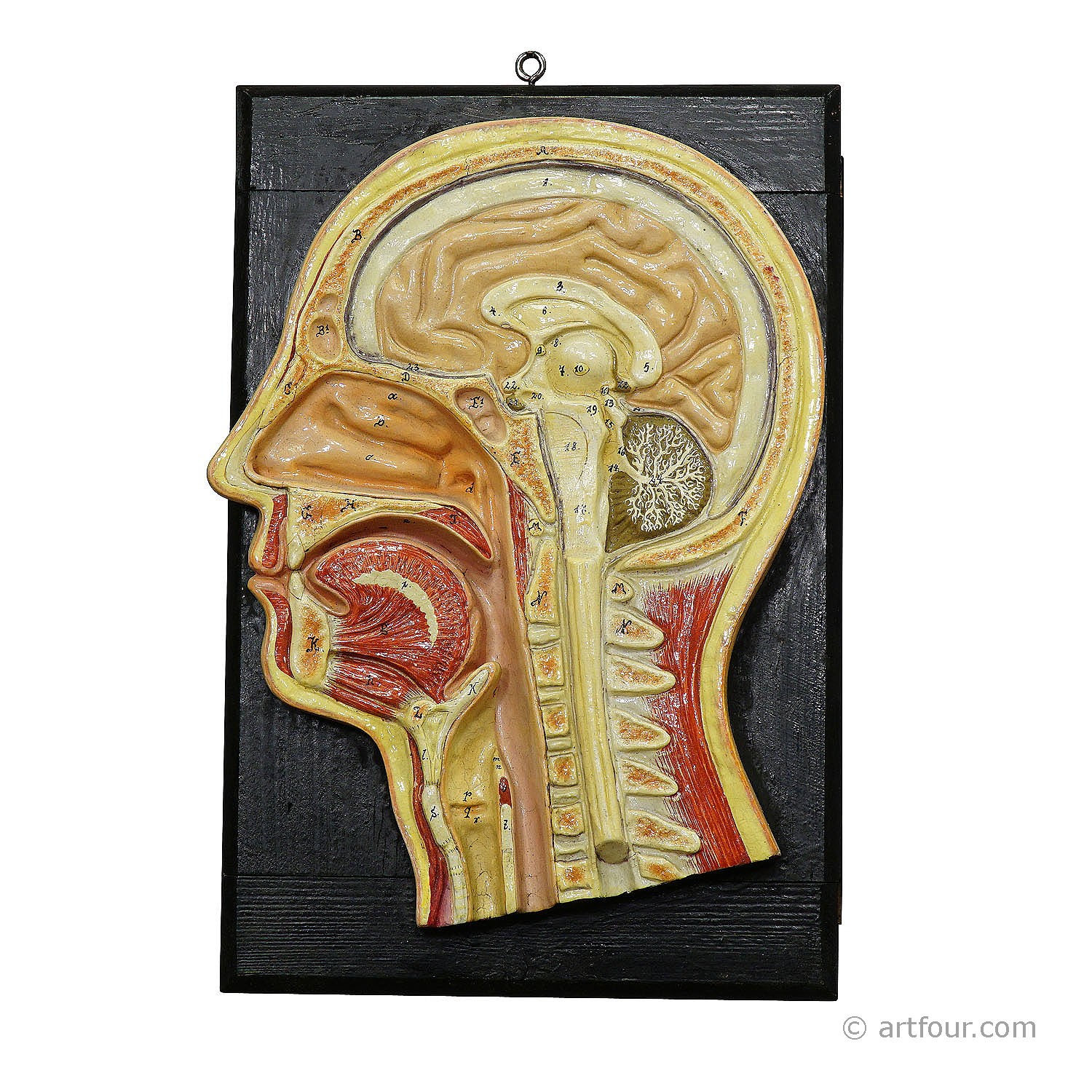 Antique Teaching Aid - Median Incision of the Human Head, ca. 1920