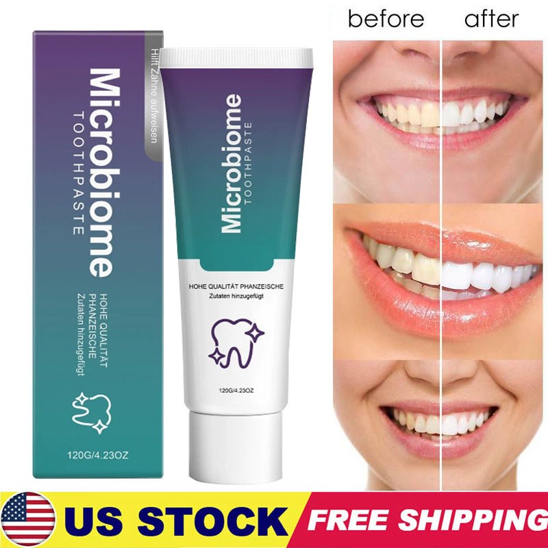 Microbiome Mint Flavor Gum Toothpaste Cleaning Toothpaste Sensitive Teeth 120g