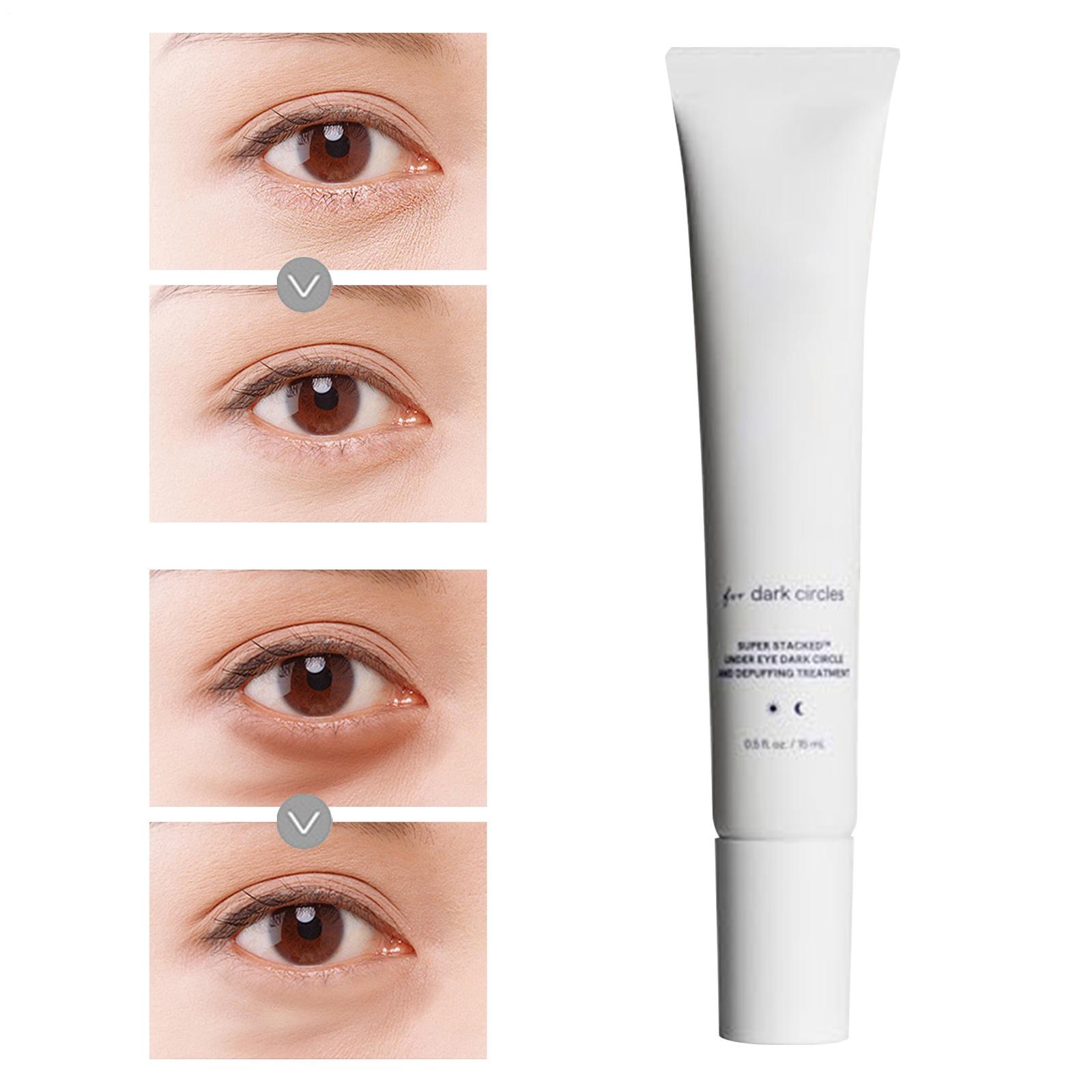Remedy Dark Circles Reducing Advanced Eye Cream 15g Eye Care Hydrating Cream