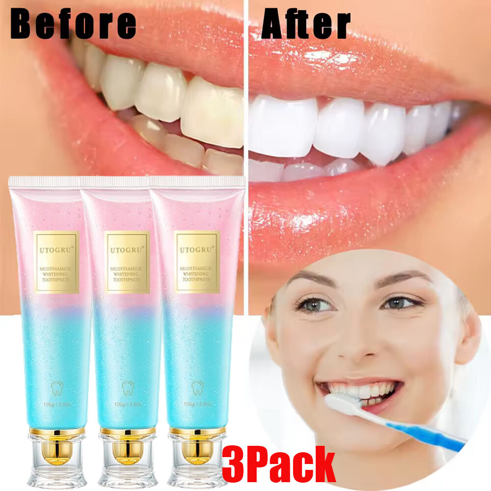 3Pcs Niacinamide Intensive Whitening Toothpaste,Remove Tooth Stains,Fresh Breath