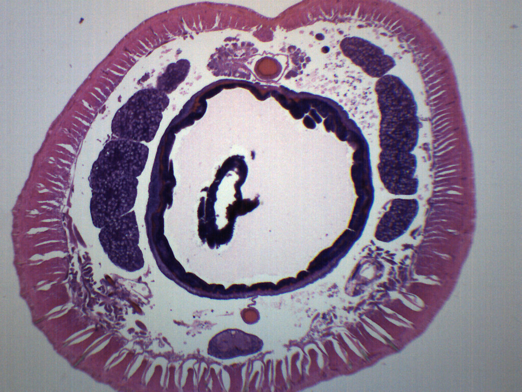 Earthworm Setae - Prepared Microscope Slide - 75x25mm - Eisco Labs