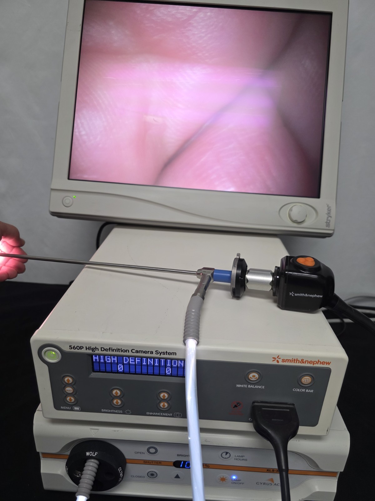 Smith & Nephew 560P HD Camera System w/ Light Source, 21" Monitor & Scope (GOOD)
