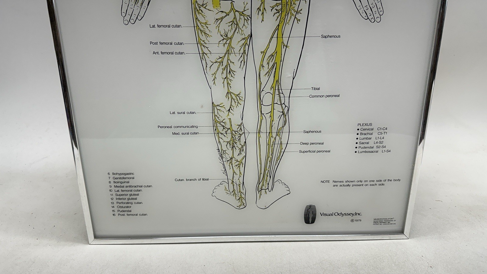Visual Odyssey Neuropatholator Medial Display - Powers on for Parts Repair READ