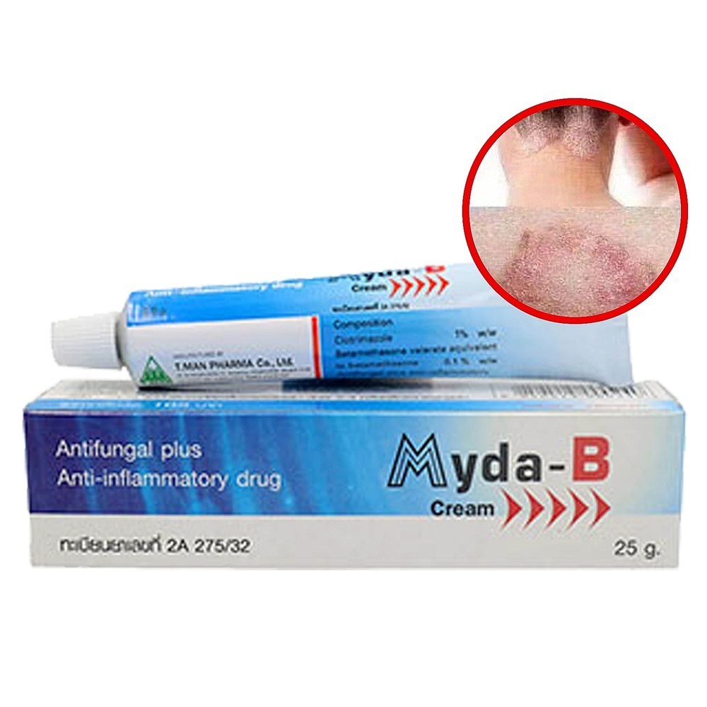 25g Myda‑B Cream Anti‑Inflammatory & Antifungal Treatment Athlete's Foot Fungal
