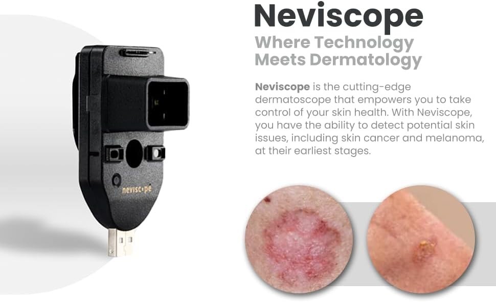 Neviscope Black Phone Dermatoscope Microscope with Polarized Lens/LED Light
