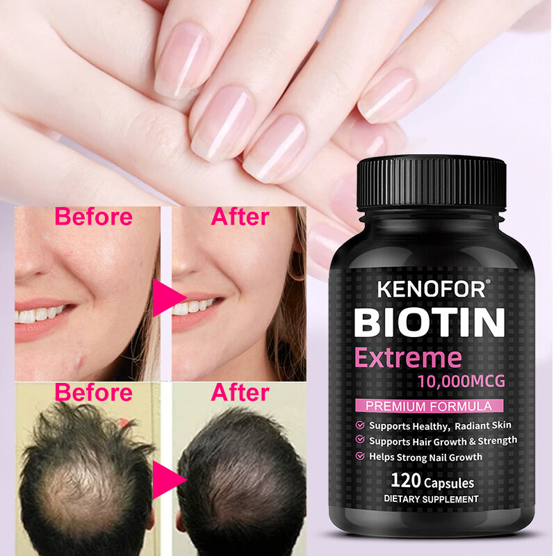 Hair, Skin & Nails Vitamins, 30to120 Capsules, 10,000 Mcg, Free Shipping