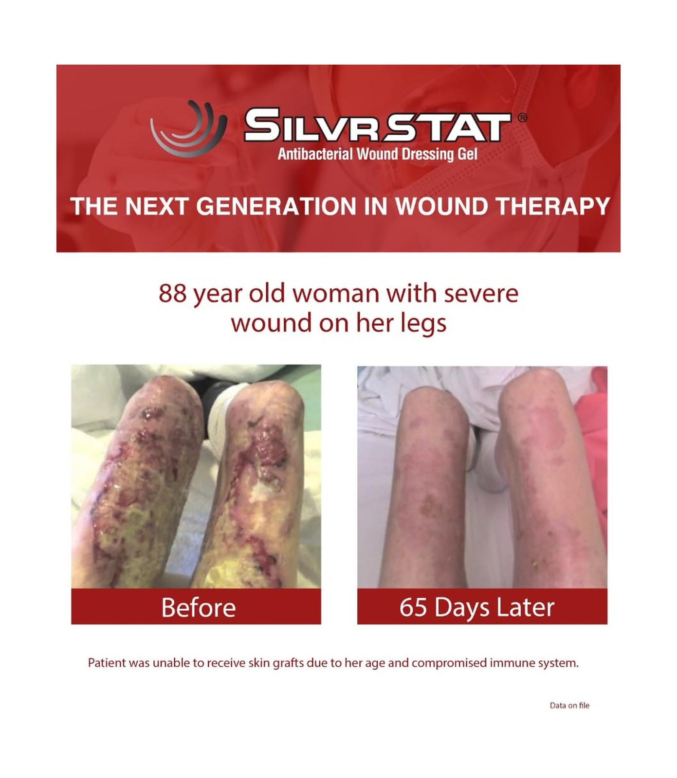 SilvrSTAT First Aid Kit Gel | 32 PPM Silver Healing Wound Dressing Solution |...