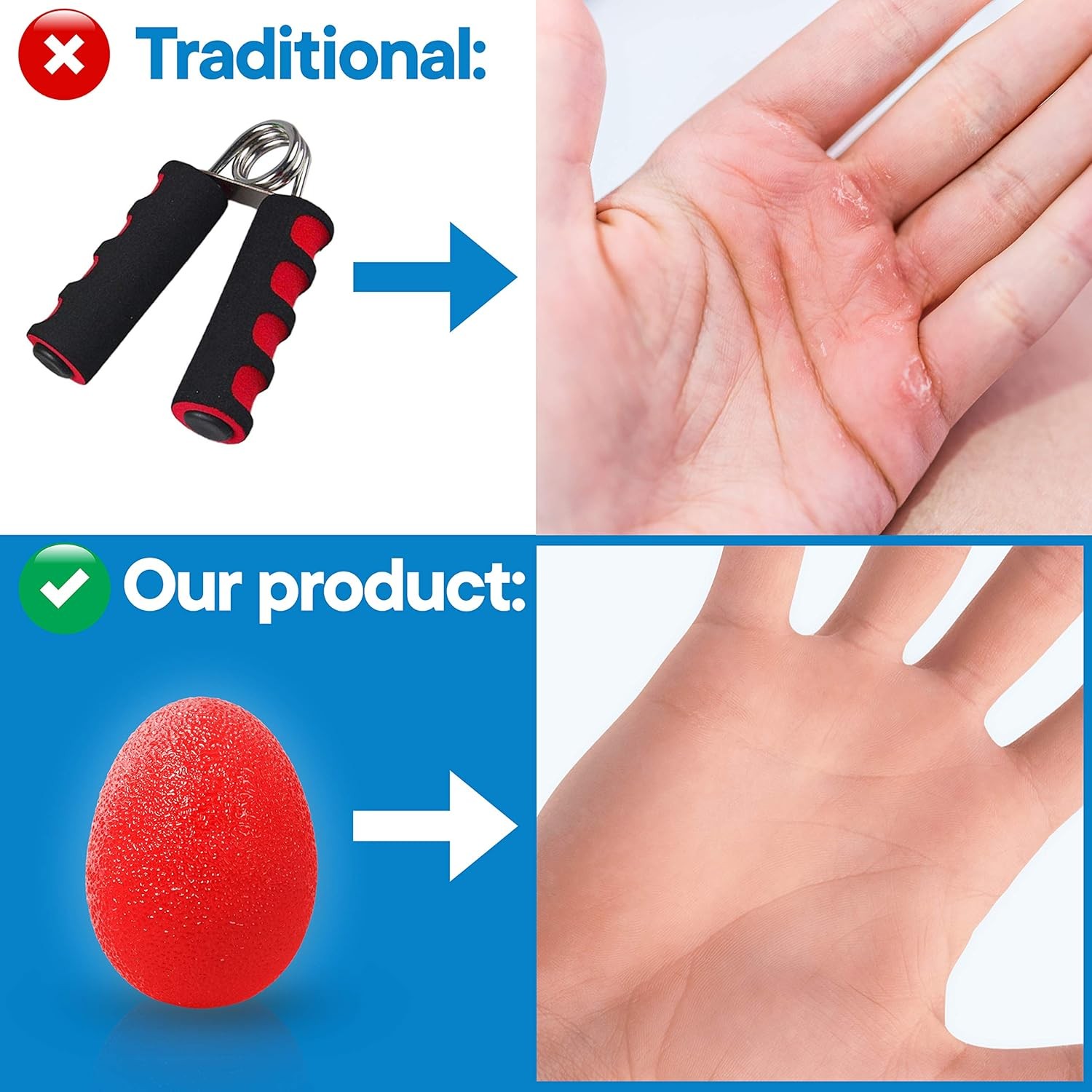 RMS 4-Pack Hand Exercise Balls - Physical & Occupational Therapy Kit for Strengt