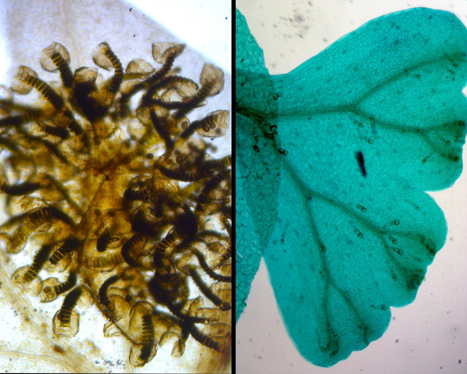 Fern (Pteridophyta) Life Cycle Composite; Showing Four Stages
