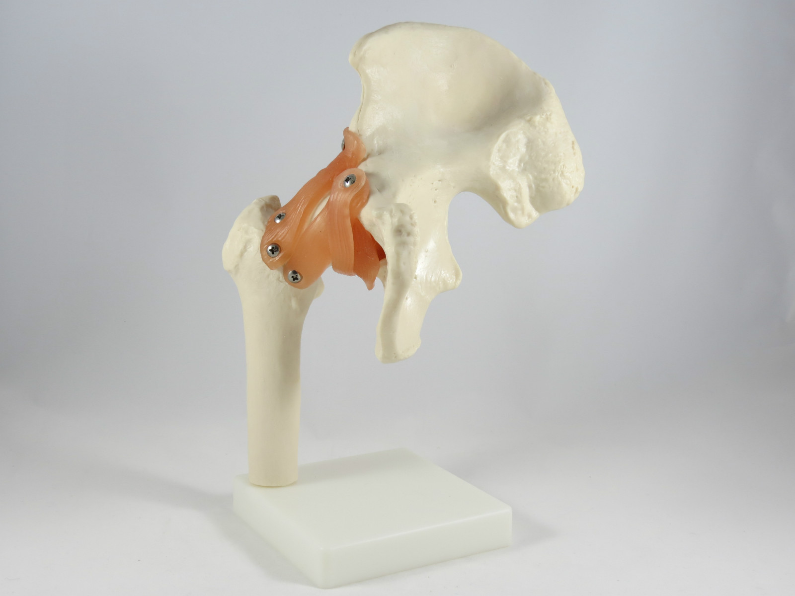 New Professional Hip Joint Medical Anatomy Model IT-009 ANGELUS