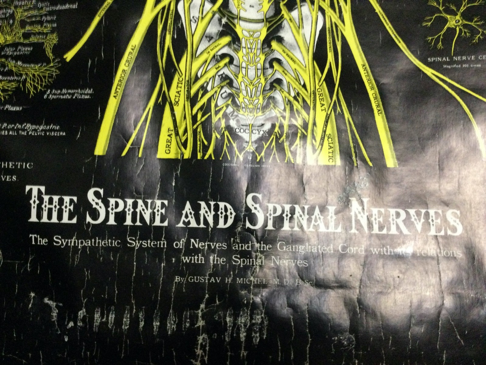 c1964 Vintage Anatomical Pull Down Chart The Spine and Spinal Nerves Dr GHMichel