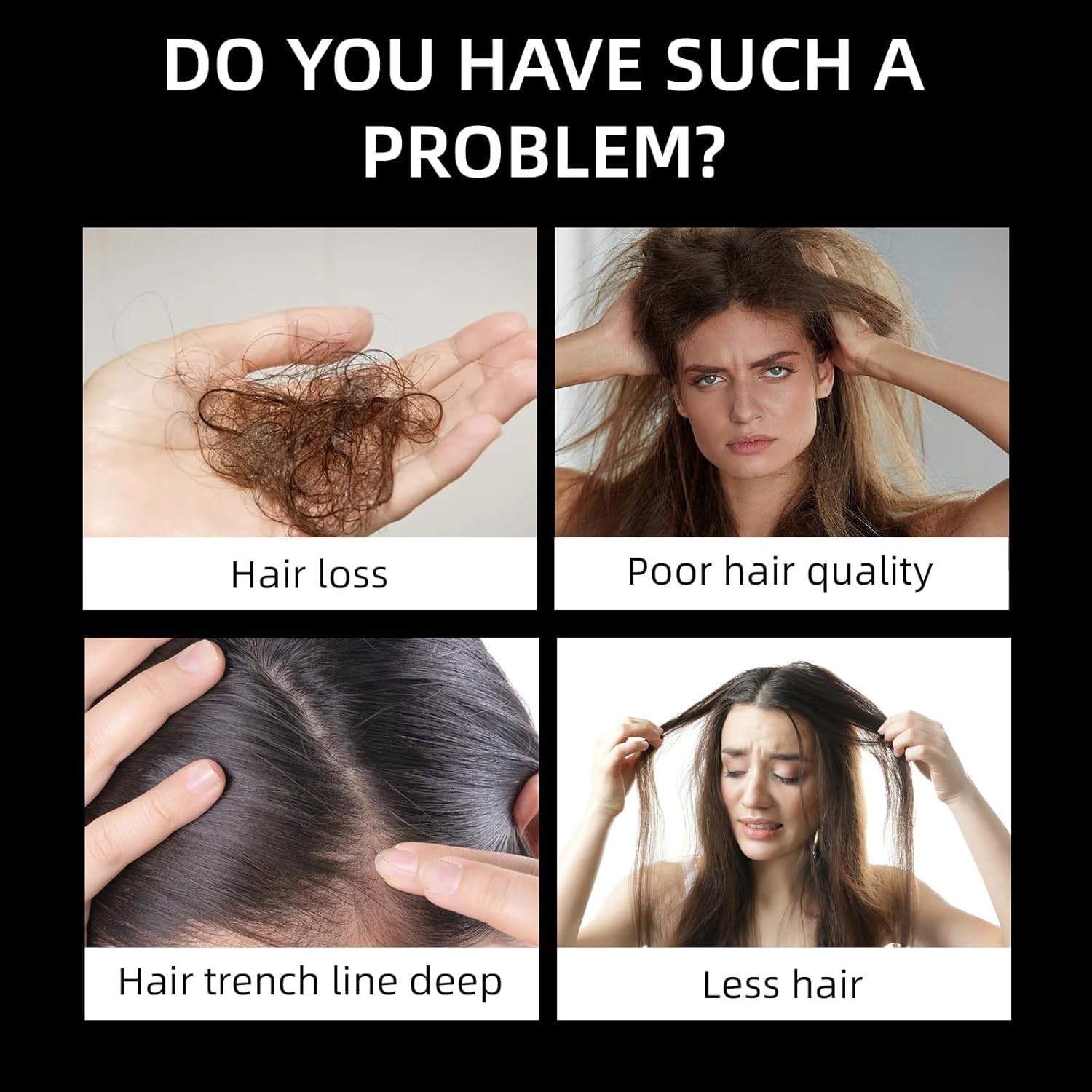 Root Activator Shampoo, SPARTAN Hair Loss Shampoo,Shampoo Root Activator US