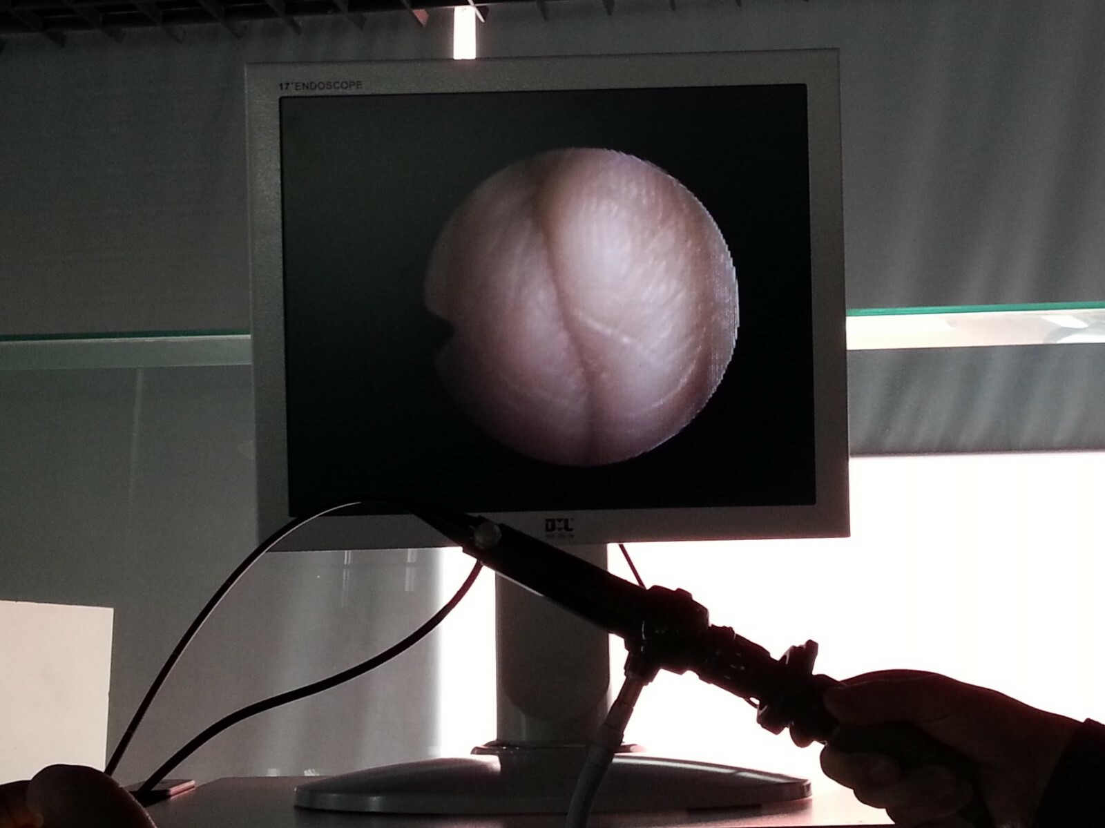 Adapter between endoscopic camera C-mount and Pantex Fiberscope connection