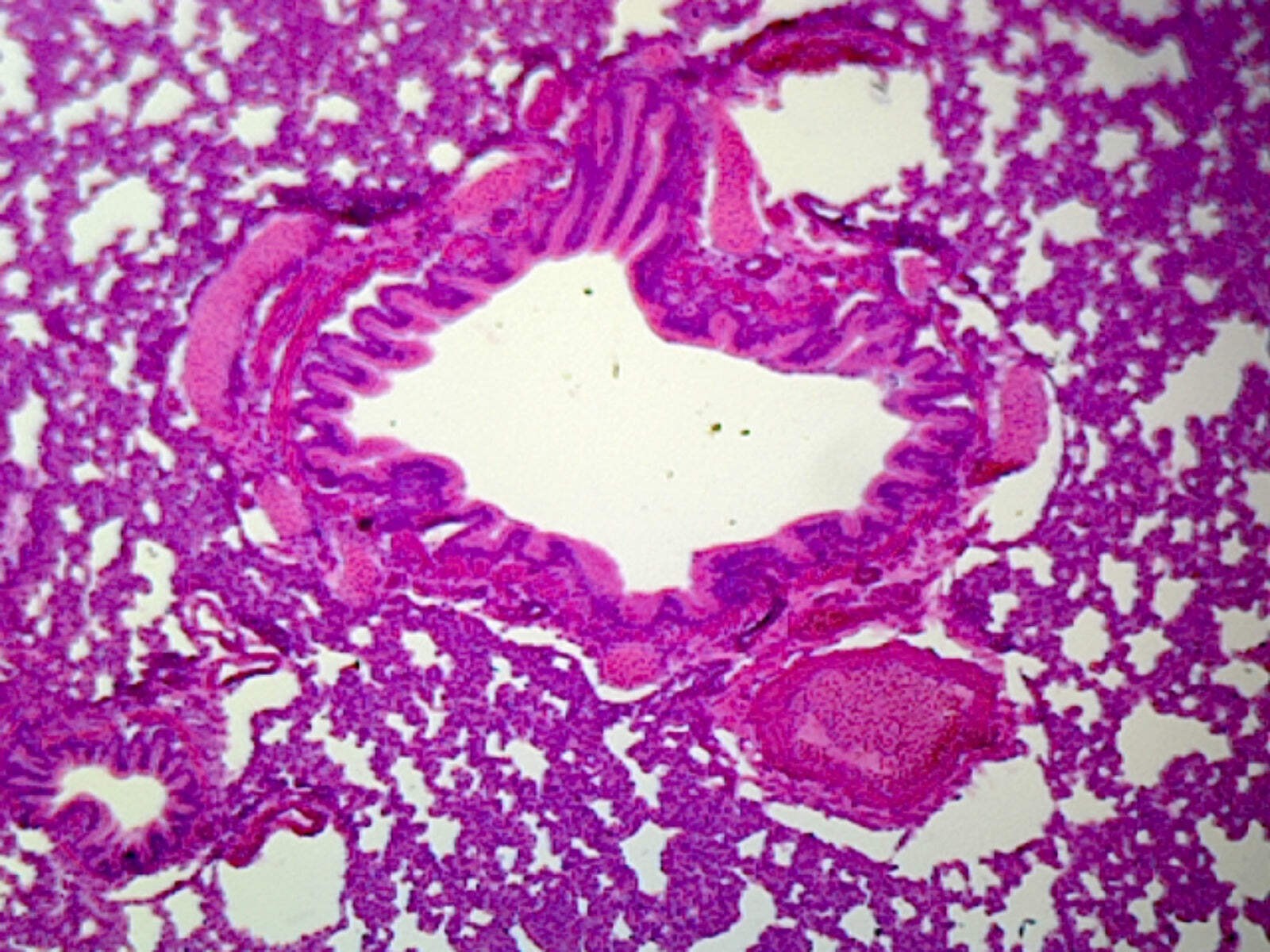 Lung Section